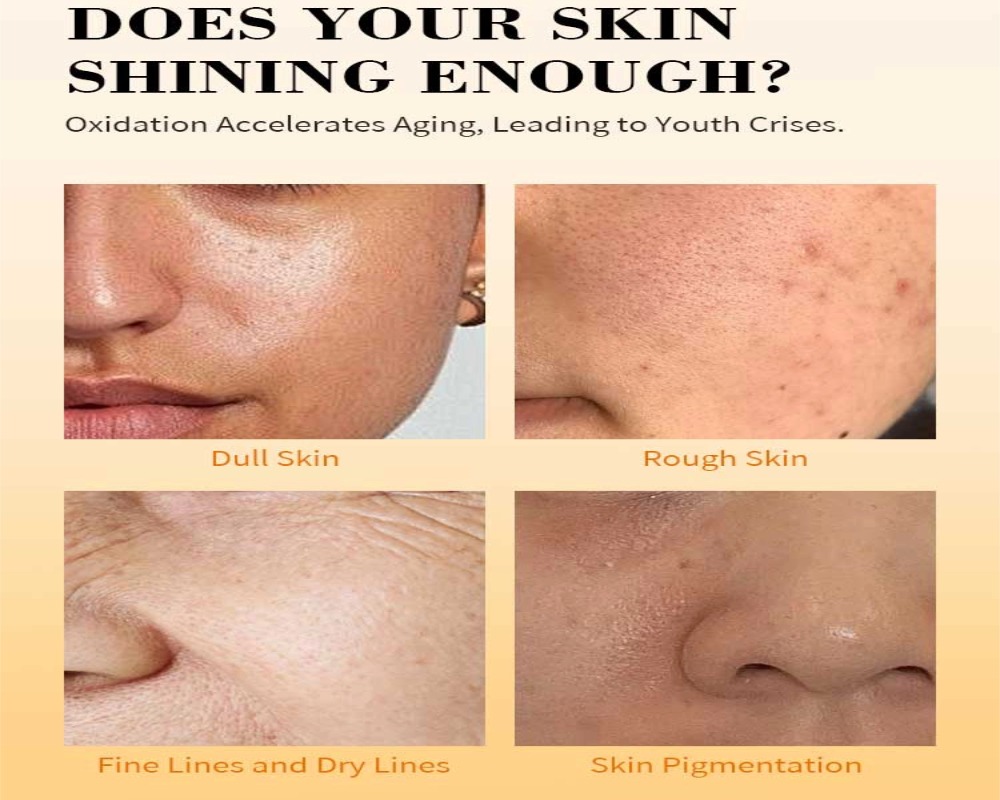 reduce dark spots